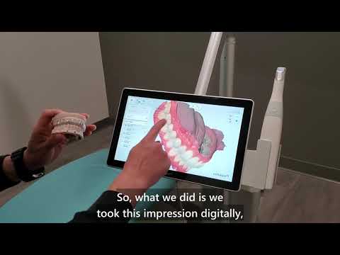 Videos from Open Late Dentistry and Orthodontics