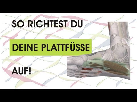 So richtest du deinen Plattfuß wieder auf! Funktioniert