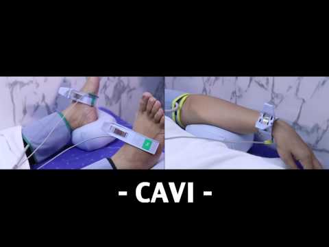 Thai International Koh Samui  Cardio Ankle Vascular Index   CAVI