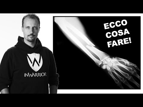 Il trattamento della malattia di osteocondrosi Preghiera per il dolore alle articolazioni e ai muscoli