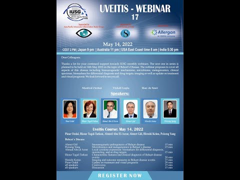 Uveitis Webinar -17 (Beheet's Disease)