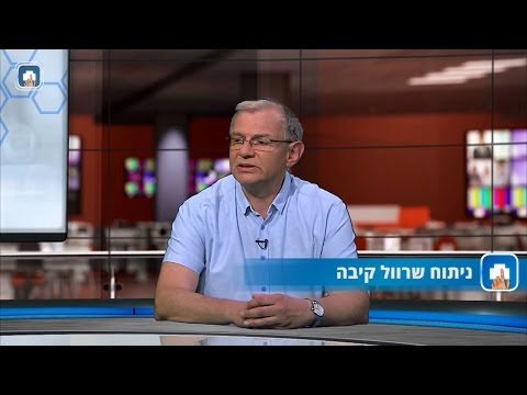 קיצור קיבה-ניתוח שרוול קיבה: המילון הרפואי