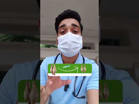 One of the major side-effect of Steroids for bodybuilding.