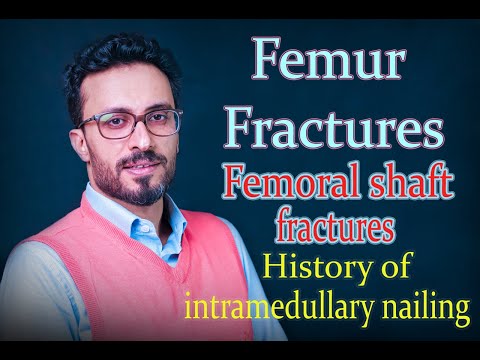 04 Femur fractures: History of intramedullary nailing