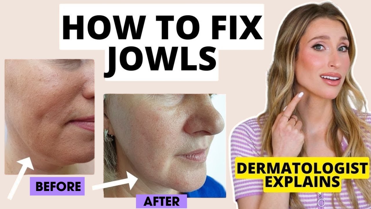 How to Fix Jowls: Dermatologist Explains How to Prevent & Get Rid of Jowls | Dr. Sam Ellis