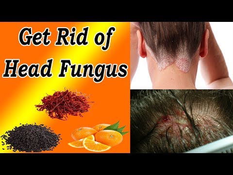Folk remedyo para sa paggamot ng fungal kuko sa paa review Kuko halamang-singaw species litrato