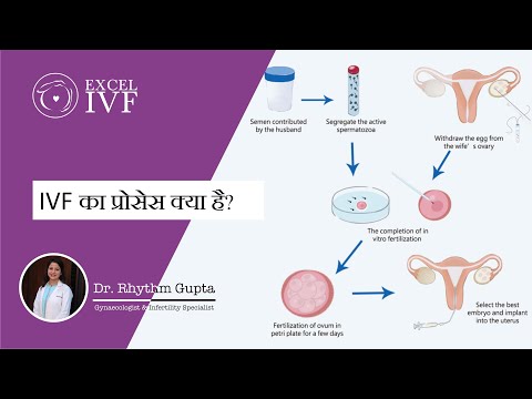 IVF का प्रोसेस क्या है? Dr Rhythm Gupta - Excel IVF