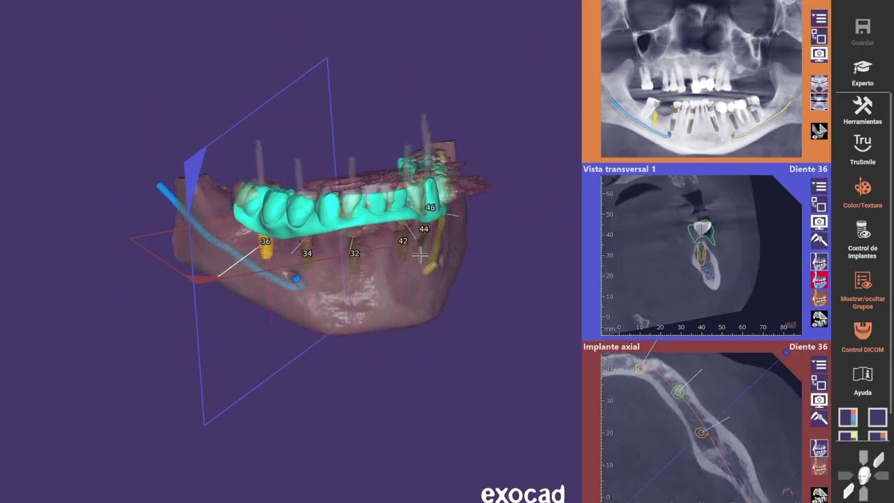 Joel Alejandro Sánchez Zúñiga-9