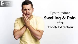 How to manage swelling & pain post tooth extraction? - Dr. Chandan Mahesh