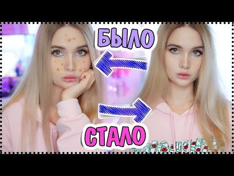 Лечение пигментных пятен на лице препараты От чего на коже появляются пигментные пятна