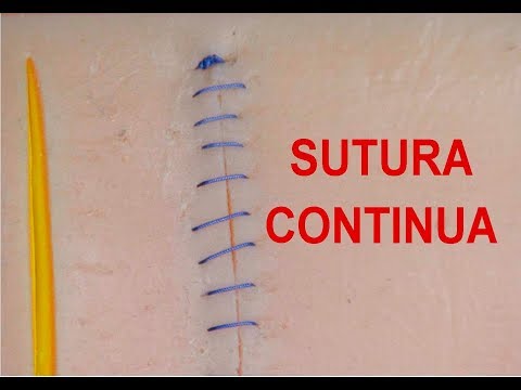 Surgical sutures. Continuous suture. Requires training and patience. The patient will appreciate it.