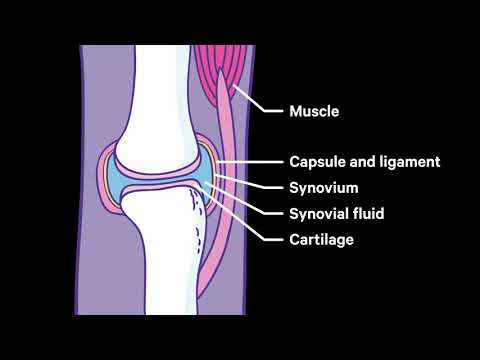 a jobb lábujj ízületének rheumatoid arthritis