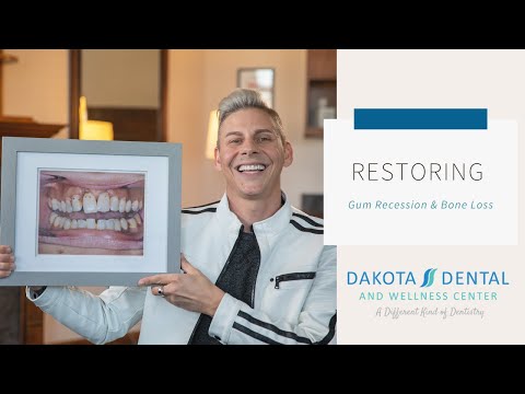 Restoring Gum Recession and Bone Loss