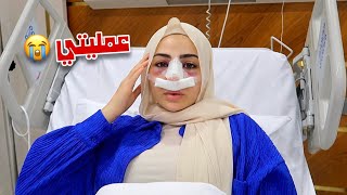 واخيراً عملت عملية تجميل أنفي????