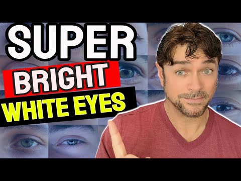 How To Get WHITER EYES | 6 Steps To Make Eyes Clear Bright & White | Chris Gibson