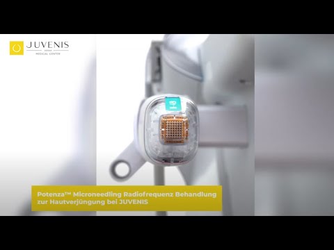Radiofrequenz Microneedling Behandlung zur Hautverjüngung bei JUVENIS in Wien