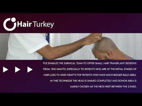 How to reach good results – FUE Technique   Hair Transplant