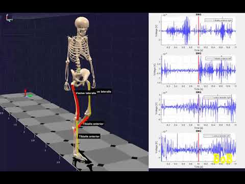EMG signals during gait