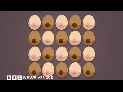 12 symptômes du cancer du sein