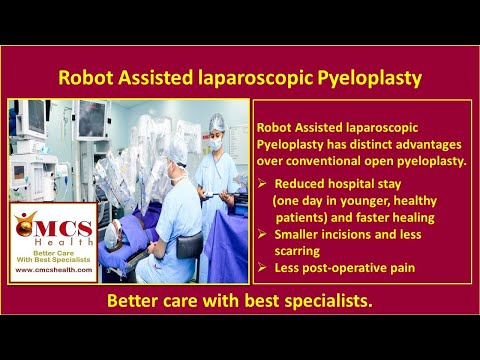 Robot assisted laparoscopic pyeloplasty for PUJ obstruction  - CMCS Health