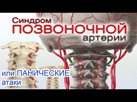 От шейного остеохондроза может быть отдышка Лекарственные препараты при артрозе коленных суставов