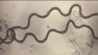 Doctors warn of rise in syphilis cases across the country