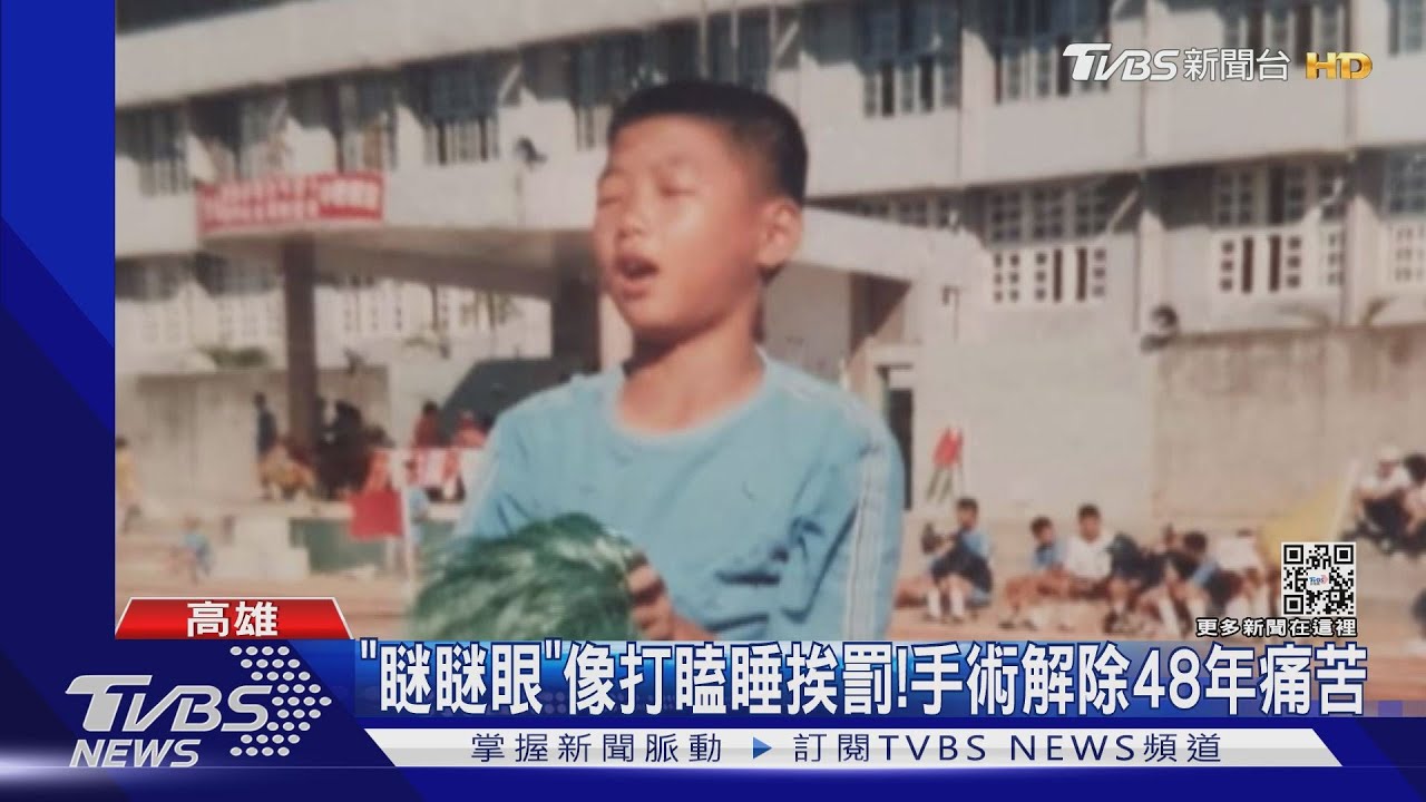「瞇瞇眼」像打瞌睡總挨罰!他動手術揮別48年痛苦