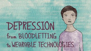 Depression: From Bloodletting to Wearable Devices