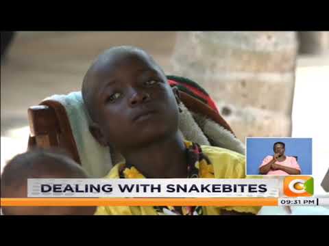 Dealing with snake bites