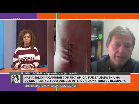 SAMPACHO: UNA MUJER FUE BALEADA MIENTRAS CAMINABA Y NO HAY DETENIDOS