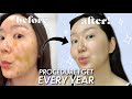 Treatments I get at Korean Dermatologist #Ulthera #SkinBotox #antiaging