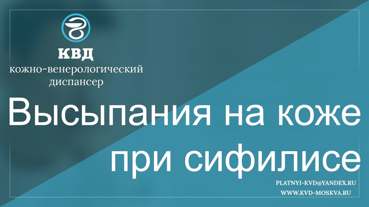 677  Высыпания на коже при сифилисе