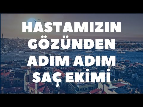 Bir hastamızın gözünden saç ekimi operasyonu süreçleri