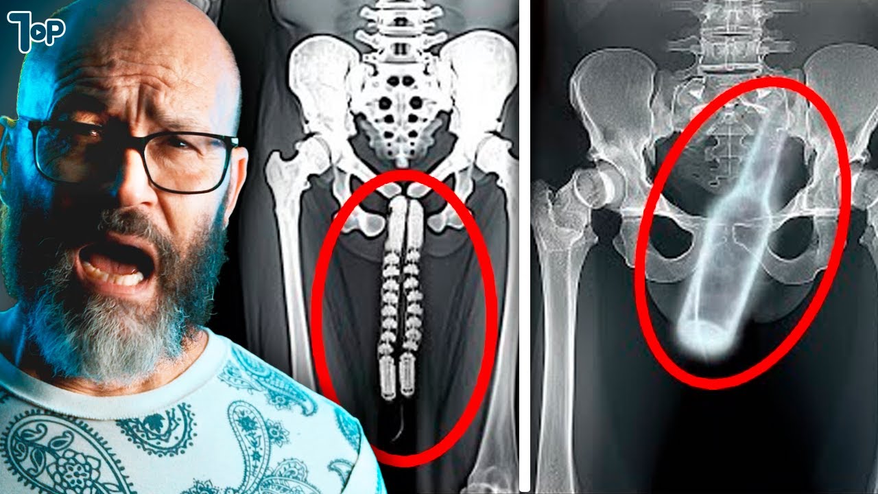 20 Coisas MUITO ESTRANHAS encontradas em RAIO-X