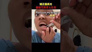 矯正器具を自分で外す人たち