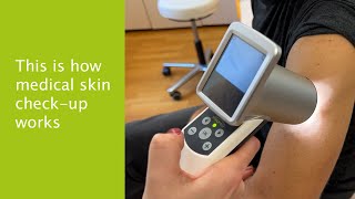 🔬 Skin cancer prevention, dermatological check-up at the Confraternität Private Hospital in Vienna
