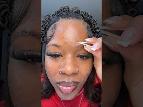 Extractions w/ Marlynnaeee 🎵 #extraction #pimplepopping #pimplepatch #acne #acnejourney #skincare