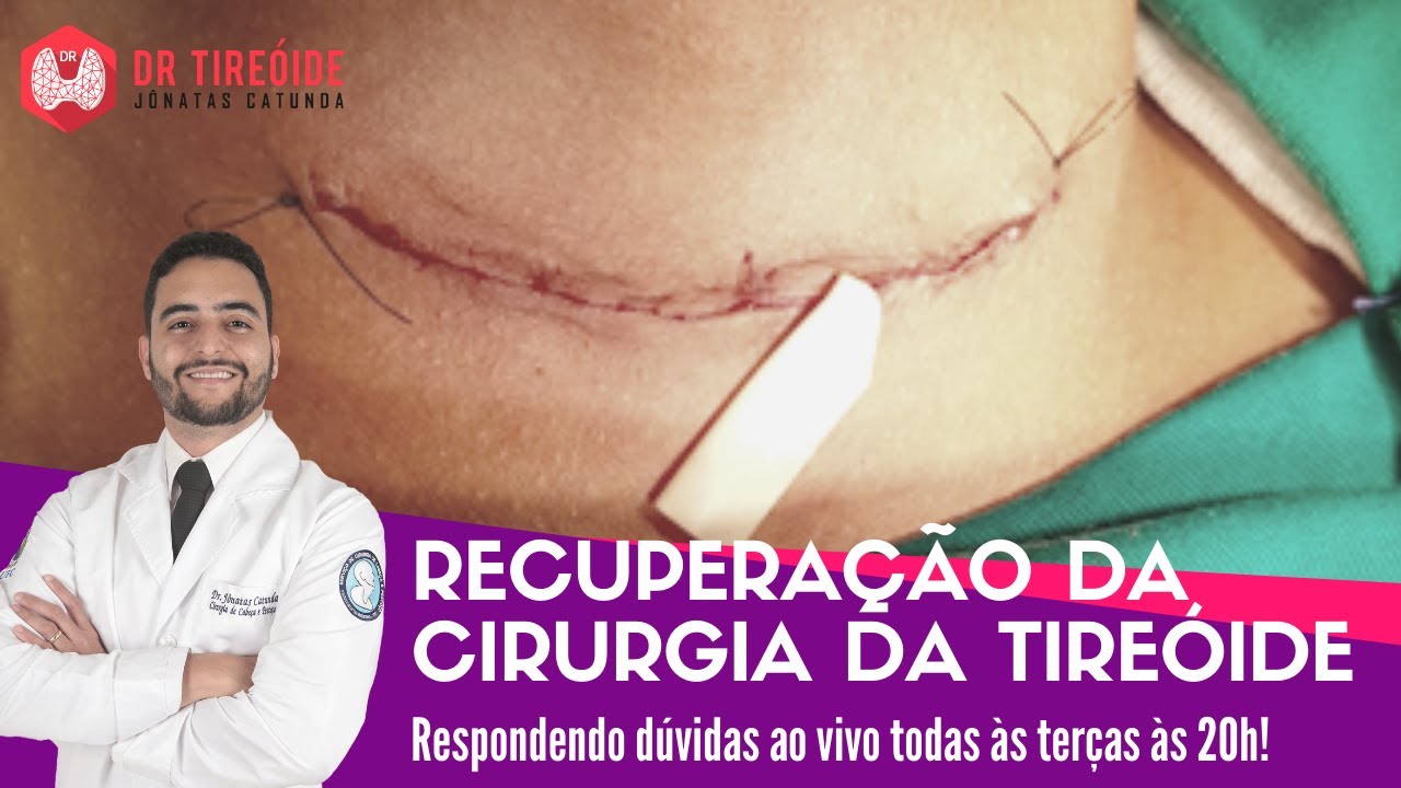Recuperação da cirurgia da tireóide  - Dr Tireóide responde #115#