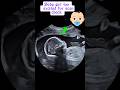 Baby Girl Too Excited For Scan Check Ultrasound Shorts Baby Pregnancy