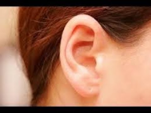 download video viral Cara Alami Menghilangkan Jerawat Di Telinga, download Cara Alami Menghilangkan Jerawat Di Telinga gratis, unduh video Cara Alami Menghilangkan Jerawat Di Telinga