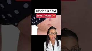 How To Get Rid of Butt Acne According to a Dermatologist #shorts