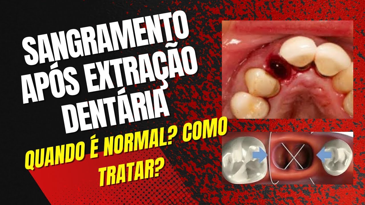 Francisco De Assis Almeida Lima Júnior-132