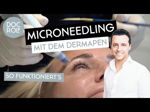 , title : 'MEDIZINISCHES MICRONEEDLING mit dem DERMAPEN® – Dr. Rolf Bartsch'