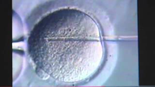 DHEA Benefits Women Trying to Get Pregnant