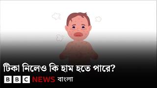 হাম রোগের টিকা প্রদান সংক্রান্ত সচেতনতা