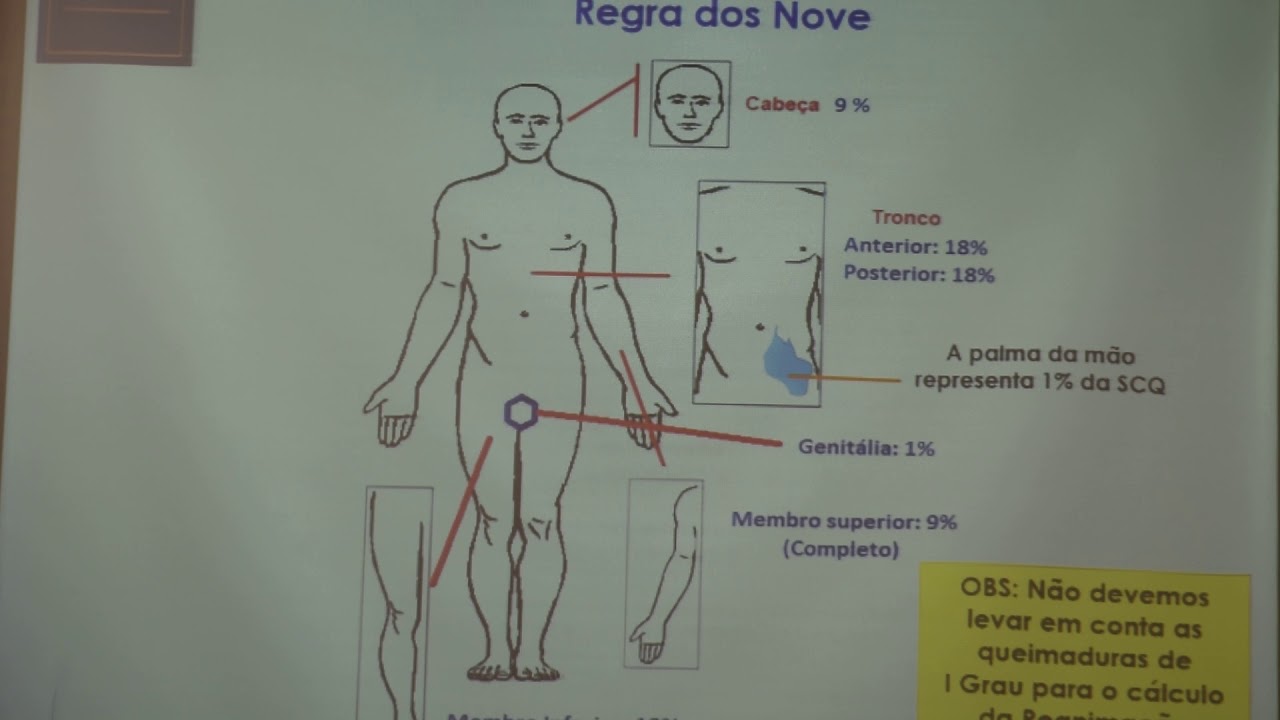 Cálculo da Superfície Corporal Queimada
