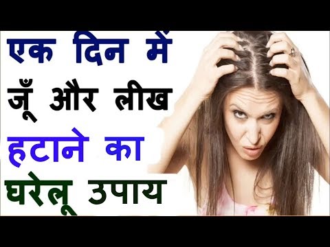 Head Lice & Nits Removal at home | सिर की लिखें और जुएं 1 ही बार में ख़तम करने का घरेलु उपाय