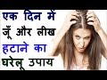 Head Lice Nits Removal At Home सिर की लिखें और जुएं 1 ही बा�