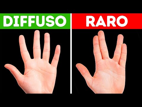 Se il Tuo Corpo Fa Queste Cose, Sei Uno su un Milione