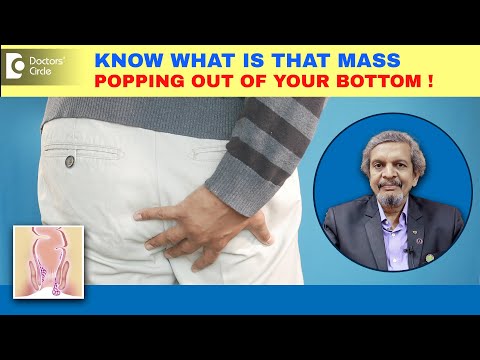 Lump or mass popping out of bottom/Anus| Hemorrhoid,Polyp,Cancer?-Dr.Rajasekhar M R| Doctors' Circle